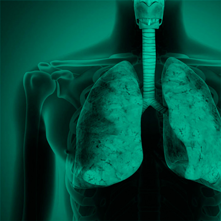 Desintoxicacion pulmonar